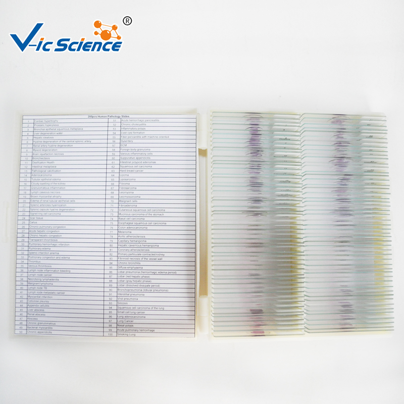 100pcs комплект човешка патология слайдове микроскопично подготвени слайдове