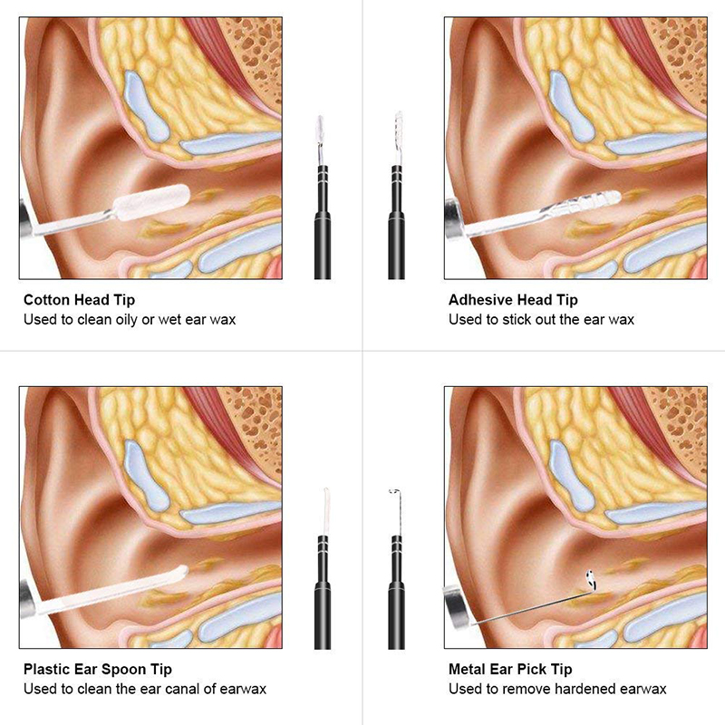 Wifi Otoscope 3 в 1 инструмент за премахване на восък за уши 720P водоустойчива камера с 6 регулируеми LED съвместими с Android и iOS