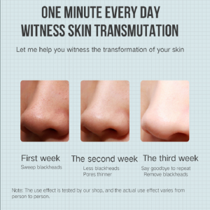 Електрически аксеритор отстраняване на акне чернокожи отстраняване на вакуумна красота машина pore cleaner