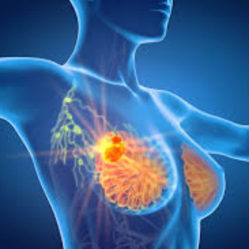 Университет Цинхуа: NMN инхибира растежа на тумора на рака на гърдата