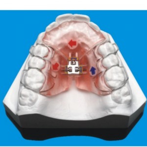 Ортодонтска серия